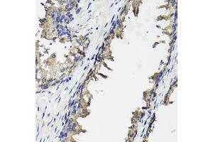 Immunohistochemistry of paraffin-embedded human prostate using OTC antibody. (OTC 抗体)
