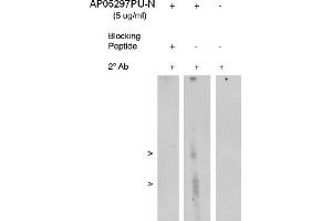 Image no. 1 for anti-Arachidonate 5-Lipoxygenase-Activating Protein (ALOX5AP) antibody (ABIN4620366) (ALOX5AP 抗体)