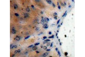 Used in DAB staining on fromalin fixed paraffin-embedded Liver tissue (IL1RN 抗体  (AA 26-177))