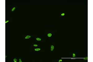 Immunofluorescence of monoclonal antibody to FUSIP1 on HeLa cell. (SRSF10 抗体  (AA 1-100))