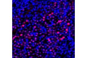 Immunofluorescence of paraffin embedded mouse kidney using Transketolase (ABIN7075978) at dilution of 1: 1100 (400x lens) (TKT 抗体)