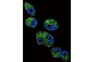 Confocal immunofluorescent analysis of CYP4A11 (4A22) Antibody (C-term) (ABIN392368 and ABIN2842004) with NCI- cell followed by Alexa Fluor 488-conjugated goat anti-rabbit lgG (green). (CYP4A11+22 (AA 407-435), (C-Term) 抗体)