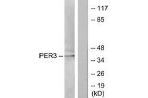 Western Blotting (WB) image for anti-Period Homolog 3 (PER3) (AA 21-70) antibody (ABIN2889525) (PER3 抗体  (AA 21-70))
