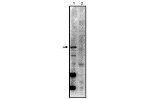 Image no. 1 for anti-Protein Phosphatase 2, Regulatory Subunit B', gamma (PPP2R5C) (AA 53-66) antibody (ABIN264946) (PPP2R5C 抗体  (AA 53-66))