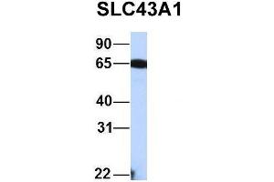Host:  Rabbit  Target Name:  FAM46C  Sample Type:  Human Fetal Liver  Antibody Dilution:  1. (SLC43A1 抗体  (Middle Region))