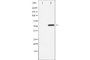 Western Blotting (WB) image for anti-Activating Transcription Factor 2 (ATF2) (pThr51), (pThr69) antibody (ABIN6256594)