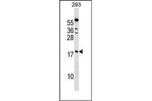 Western blot analysis of PPIL1 Antibody (Center) in 293 cell line lysates (35ug/lane). (PPIL1 抗体  (Middle Region))