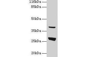 Western blot All lanes: Gamt antibody at 2 μg/mL + Rat liver tissue Secondary Goat polyclonal to rabbit IgG at 1/10000 dilution Predicted band size: 27 kDa Observed band size: 27 kDa (GAMT 抗体  (AA 1-236))