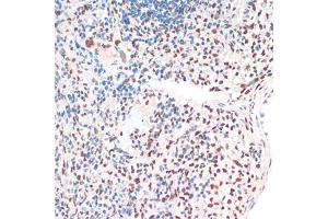 Immunohistochemistry of paraffin-embedded rat spleen using TDP-43/TARDB antibody (ABIN7270731) at dilution of 1:200 (40x lens).