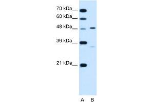 WB Suggested Anti-CHST1 Antibody Titration:  1. (CHST1 抗体  (N-Term))