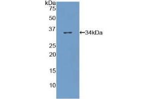 Western Blotting (WB) image for Collagen, Type VII, alpha 1 (COL7A1) ELISA Kit (ABIN6730965)