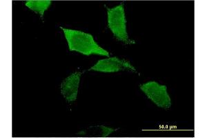 Immunofluorescence (IF) image for anti-Z-DNA Binding Protein 1 (ZBP1) (AA 2-100) antibody (ABIN529332)