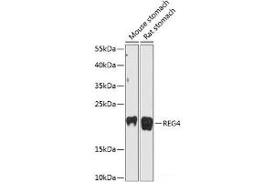 Western blot analysis of extracts of various cell lines using REG4 Polyclonal Antibody at dilution of 1:3000. (REG4 抗体)