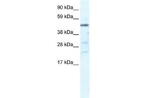 WB Suggested Anti-HSFY1 Antibody Titration:  5. (HSFY1 抗体  (N-Term))