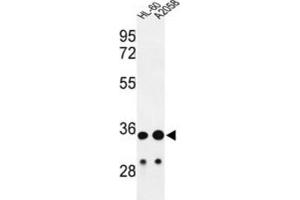 Western Blotting (WB) image for anti-Immunoglobulin Heavy Chain (IgH) antibody (ABIN2995207) (IgH 抗体)