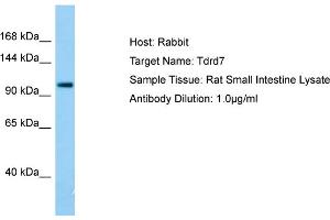 Host: RabbitTarget Name: Tdrd7Antibody Dilution: 1. (TDRD7 抗体  (C-Term))