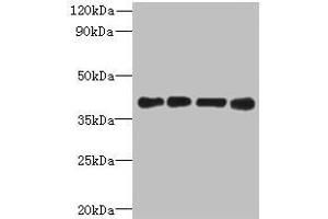 Western blot All lanes: MAGEB18 antibody at 12 μg/mL Lane 1: MCF-7 whole cell lysate Lane 2: A549 whole cell lysate Lane 3: Hela whole cell lysate Lane 4: Mouse heart tissue Secondary Goat polyclonal to rabbit IgG at 1/10000 dilution Predicted band size: 39 kDa Observed band size: 39 kDa (MAGEB18 抗体  (AA 1-270))