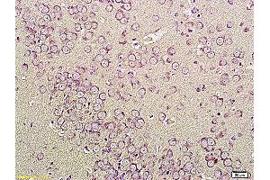 Formalin-fixed and paraffin embedded human cervical tissue labeled with Anti-CNR1 Polyclonal Antibody, Unconjugated (ABIN732923) at 1:200, followed by conjugation to the secondary antibody and DAB staining (CNR1 抗体  (AA 401-472))