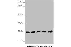 Western blot All lanes: EEF1B2 antibody at 0. (EEF1B2 抗体  (AA 1-225))
