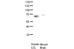 ETS2 antibody - middle region  validated by WB using human LCL and mouse brains at 1:1000. (ETS2 抗体  (Middle Region))