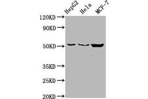 Western Blot Positive WB detected in: HepG2 whole cell lysate, Hela whole cell lysate, MCF-7 whole cell lysate All lanes: CDS2 antibody at 6 μg/mL Secondary Goat polyclonal to rabbit IgG at 1/50000 dilution Predicted band size: 52, 30 kDa Observed band size: 52 kDa