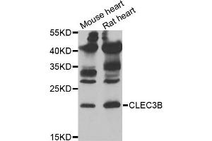 Western blot analysis of extracts of various cell lines, using CLEC3B antibody (ABIN5973819) at 1/1000 dilution. (CLEC3B 抗体)