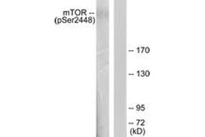 Western blot analysis of extracts from HeLa cells treated with EGF 200ng/ml 30', using mTOR (Phospho-Ser2448) Antibody. (MTOR 抗体  (pSer2448))