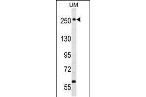 Western blot analysis in uterus tumor cell line lysates (35ug/lane). (WNK3 抗体  (C-Term))