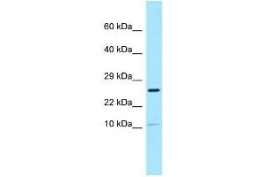 WB Suggested Anti-SPRN Antibody Titration: 1. (SPRN 抗体  (N-Term))