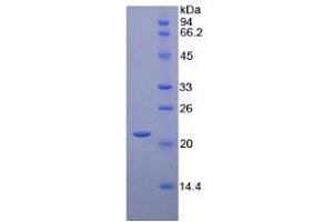 SDS-PAGE analysis of Human CD8b Protein. (CD8B 蛋白)
