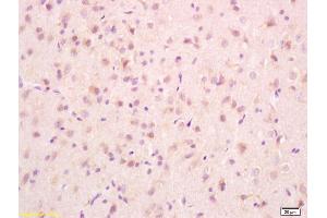 Formalin-fixed and paraffin embedded rat brain tissue labeled with Anti-PCMT1 Polyclonal Antibody, Unconjugated (ABIN715796) at 1:200, followed by conjugation to the secondary antibody and DAB staining (PCMT1 抗体  (AA 165-227))