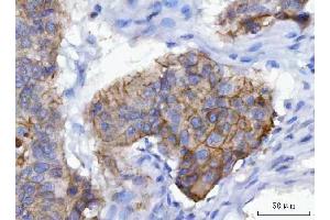 IHC analysis of gamma Catenin using anti-gamma Catenin antibody (ABIN7602031).