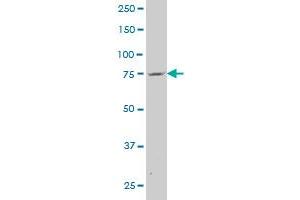 Western Blotting (WB) image for anti-ATP-Binding Cassette, Sub-Family A (ABC1), Member 6 (ABCA6) (AA 53-149) antibody (ABIN565089)