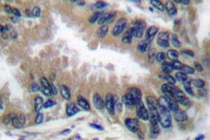 Image no. 1 for anti-Apoptotic Peptidase Activating Factor 1 (APAF1) antibody (ABIN265312) (APAF1 抗体)