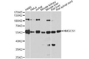 Western blot analysis of extracts of various cell lines, using HMGCS1 antibody (ABIN5972092) at 1:7000 dilution. (HMGCS1 抗体)