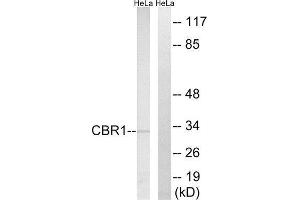 Western Blotting (WB) image for anti-Carbonyl Reductase 1 (CBR1) (Internal Region) antibody (ABIN1851014) (CBR1 抗体  (Internal Region))