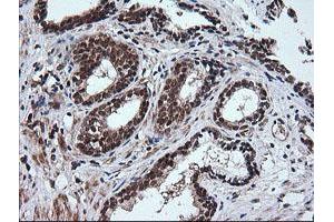 Image no. 6 for anti-Rhotekin (RTKN) antibody (ABIN1500702)