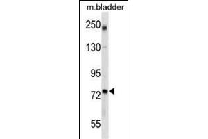 GCLC Antibody (Center) (ABIN1538246 and ABIN2849959) western blot analysis in mouse bladder tissue lysates (35 μg/lane). (GCLC 抗体  (AA 286-315))