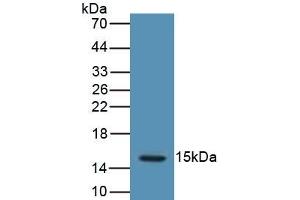 Detection of Recombinant LHb, Human using Polyclonal Antibody to Luteinizing Hormone Beta Polypeptide (LHb) (LHB 抗体  (AA 23-141))