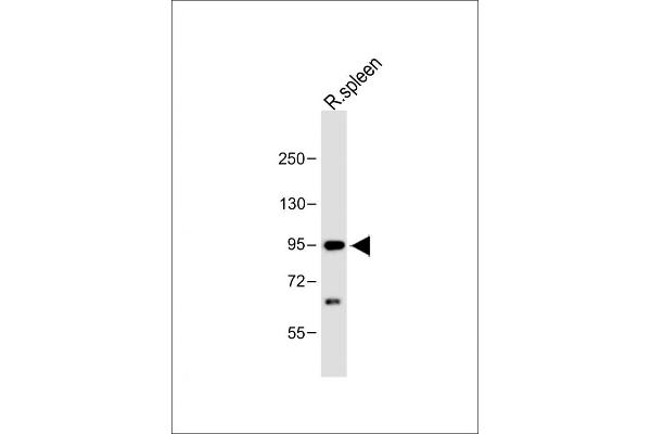 Cbl Proto-Oncogene B, E3 Ubiquitin Protein Ligase (CBLB) (AA 103-130) 抗体