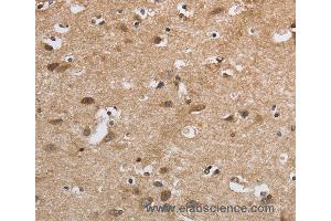 Immunohistochemistry of Human brain  using SDCCAG3 Polyclonal Antibody at dilution of 1:30
