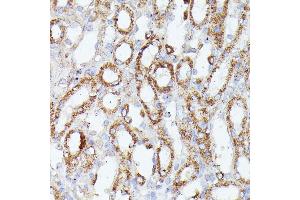 Immunohistochemistry of paraffin-embedded mouse kidney using CDK5R antibody (ABIN7266235) at dilution of 1:100 (40x lens). (CDK5RAP1 抗体  (AA 1-350))