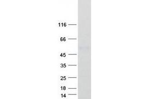 Western Blotting (WB) image for Apolipoprotein H (Beta-2-Glycoprotein I) (APOH) protein (Myc-DYKDDDDK Tag) (ABIN2714834)