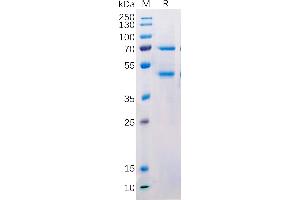 SDS-PAGE (SDS) image for Mannan-Binding Lectin serine Peptidase 2 (MASP2) protein (Fc Tag) (ABIN7092694)