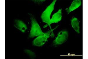 Immunofluorescence of  purified  MaxPab antibody to NCF2 on HeLa cell. (NCF2 抗体  (AA 1-526))