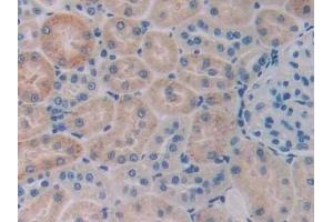 Detection of CBG in Rat Kidney Tissue using Monoclonal Antibody to Corticosteroid Binding Globulin (CBG) (SERPINA6 抗体  (AA 173-344))