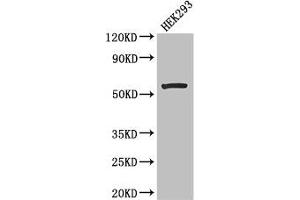 Western Blot Positive WB detected in: HEK293 whole cell lysate All lanes: MLYCD antibody at 2. (MLYCD 抗体  (AA 40-493))