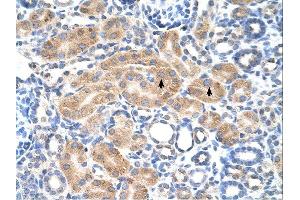 PDE9A antibody was used for immunohistochemistry at a concentration of 4-8 ug/ml. (PDE9A 抗体  (N-Term))