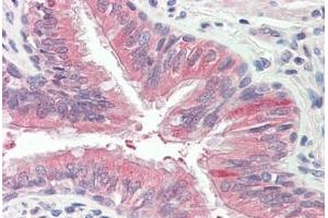 Human Lung, Respiratory Epithelium: Formalin-Fixed, Paraffin-Embedded (FFPE) (EPS8-Like 2 抗体  (AA 1-50))