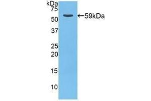 Detection of Recombinant CTSD, Rat using Polyclonal Antibody to Cathepsin D (CTSD) (Cathepsin D 抗体  (AA 120-407))